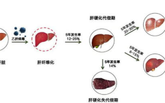 乙型肝炎症状,全面了解病毒性肝炎的典型表现