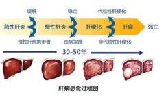 乙型肝炎症状,全面了解病毒性肝炎的典型表现